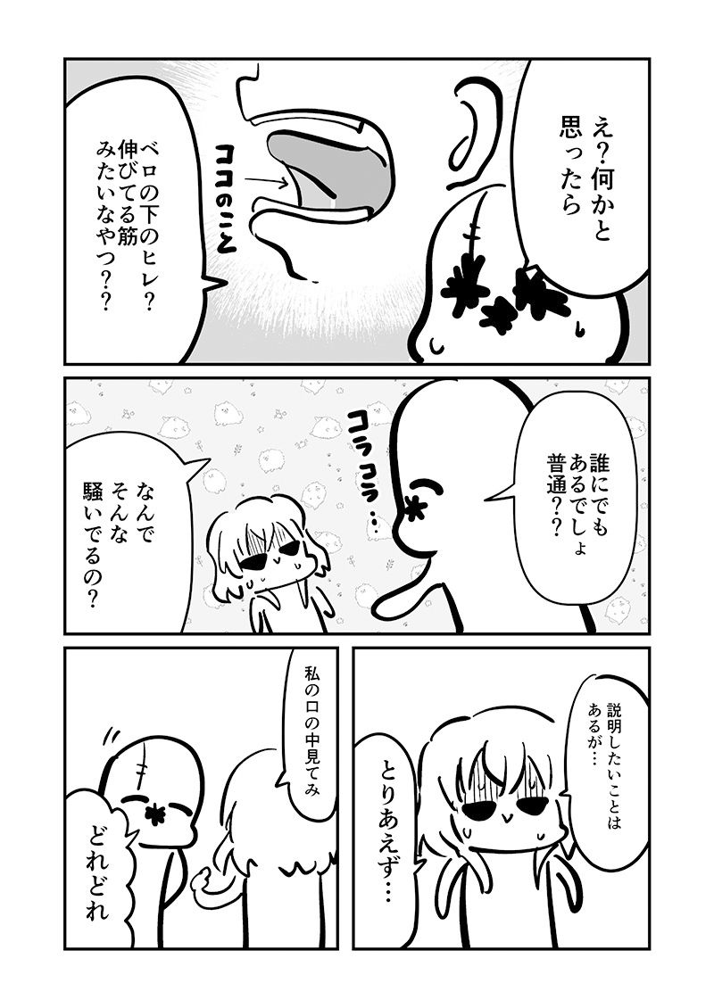 ベロをレーザーで焼いた話16